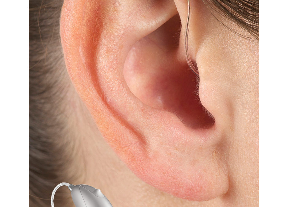 #4: What is included in the price of hearing aids?